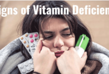 What Are the Common Symptoms of Vitamin Deficiency?